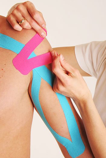 Colocación de Kinesiotaping